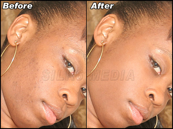 Face Clearning And Tattoo Removal (Photo Retouching Example)